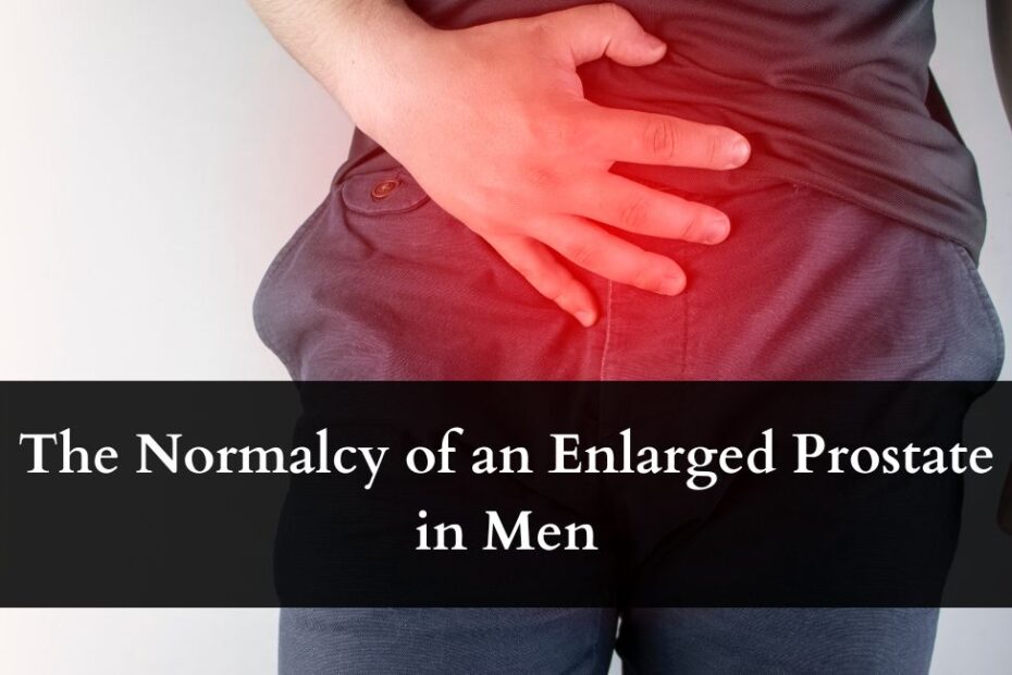 The Normalcy of an Enlarged Prostate in Men