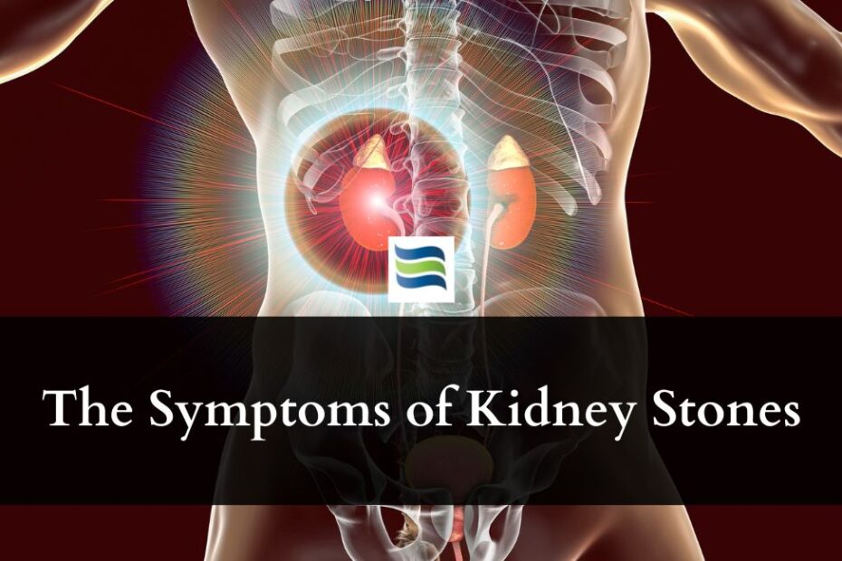 The Symptoms of Kidney Stones